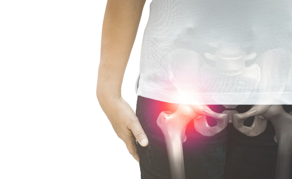 Hip Osteoarthritis an Introduction